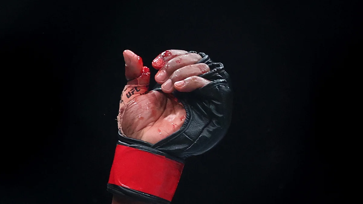 UFC: lutador recebe suspensão de seis meses por fratura exposta em duelo