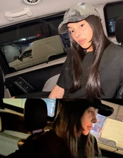 Pabllo Vittar já havia realizado procedimentos no nariz em 2018 e em 2021